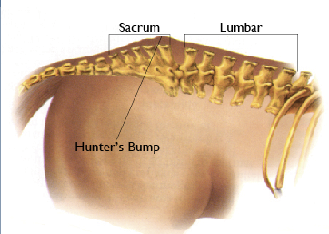 Identify and Treat Equine Sacroiliac Problems promo image